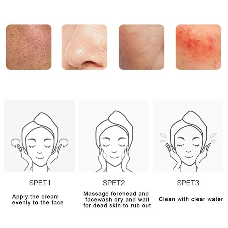 Face Exfoliating Gel Fruit Acid Facial Exfoliator Scrub Cleanses Whitening Acne Blackhead Treatment Shrink Pores Skin Care 80g