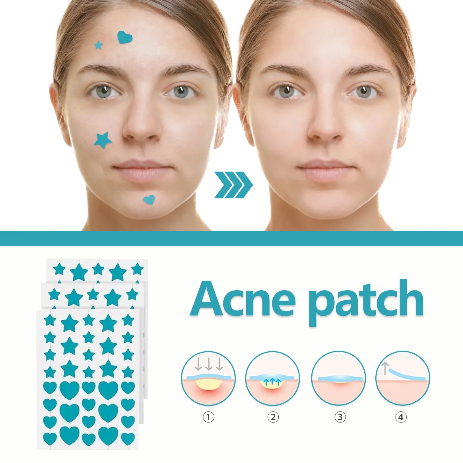 Hydrocolloid Acne Patch Repair Acne Cleansing Invisible Breathable Waterproof Acne Cleansing Concealer Fade Clean