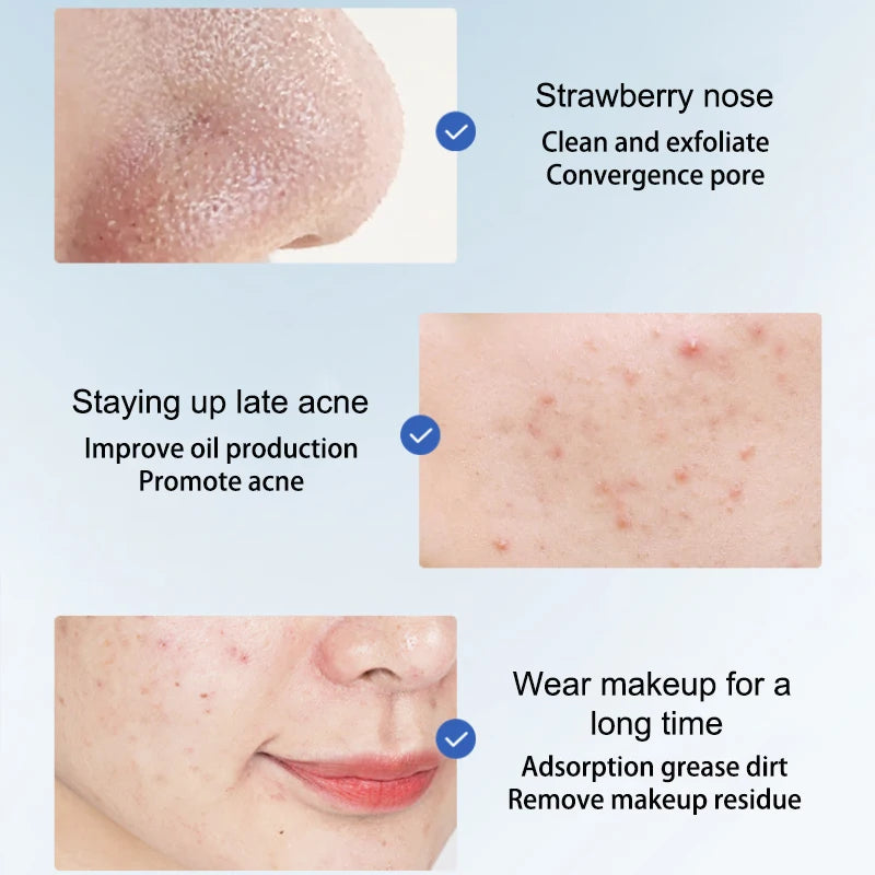 Face Clean Mask Green Tea Cleansing Stick Mask Men'S Blackheads Remove Pimples Shrink And Tear Nasal Strips facial Acne MasK