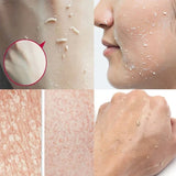 Face Exfoliating Gel Fruit Acid Facial Exfoliator Scrub Cleanses Whitening Acne Blackhead Treatment Shrink Pores Skin Care 80g