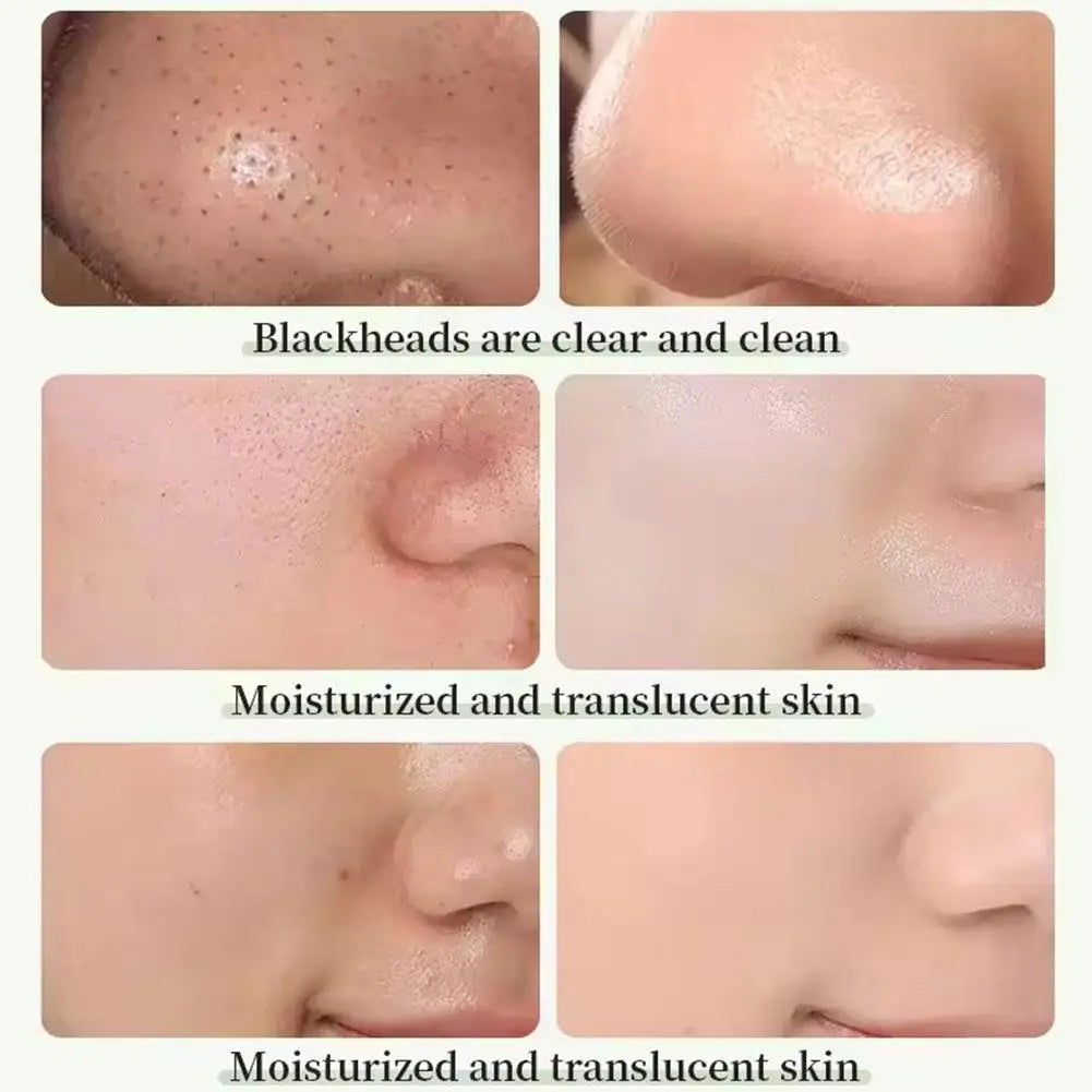 Face Clean Mask Green Tea Cleansing Stick Mask Men'S Blackheads Remove Pimples Shrink And Tear Nasal Strips facial Acne MasK
