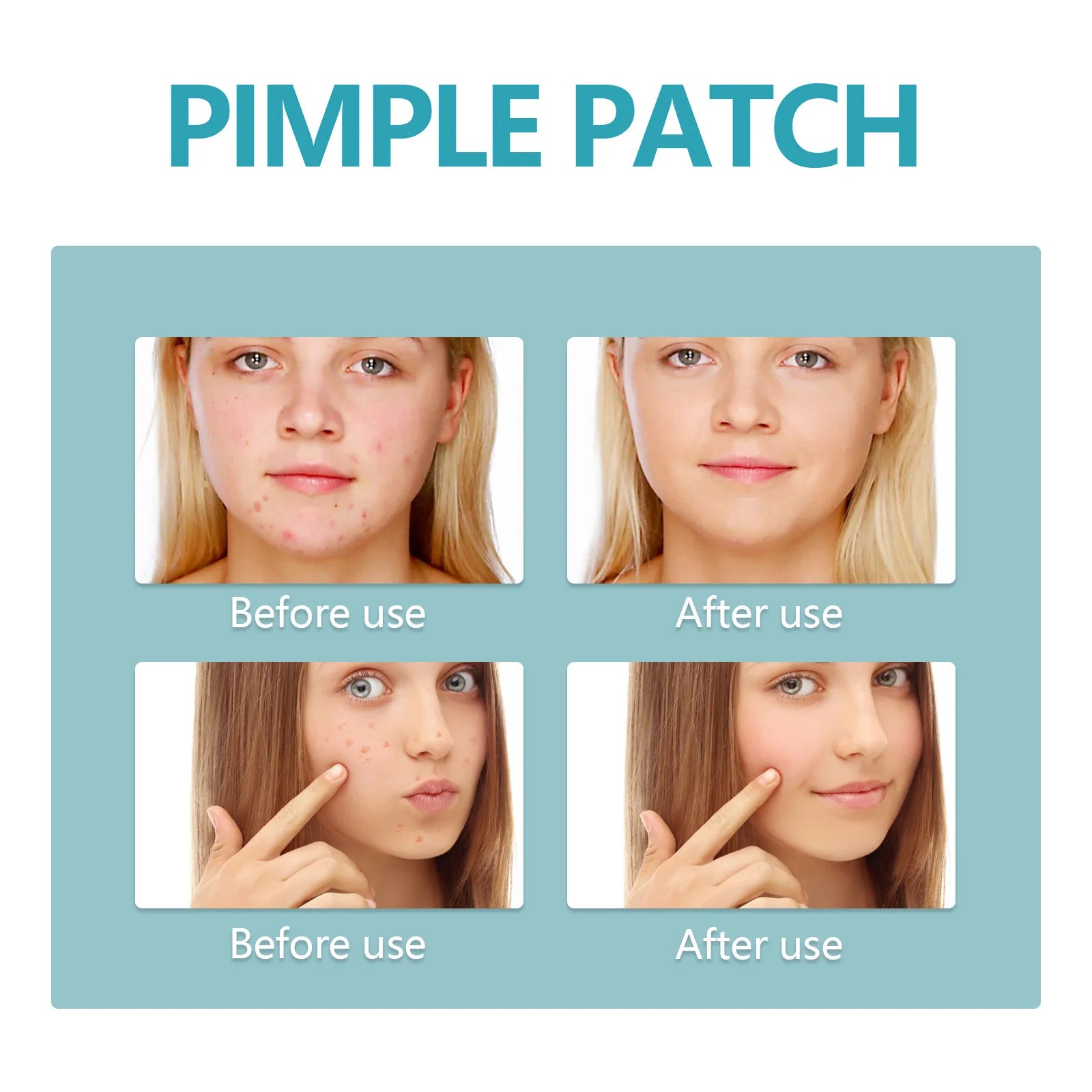 Hydrocolloid Acne Patch Repair Acne Cleansing Invisible Breathable Waterproof Acne Cleansing Concealer Fade Clean