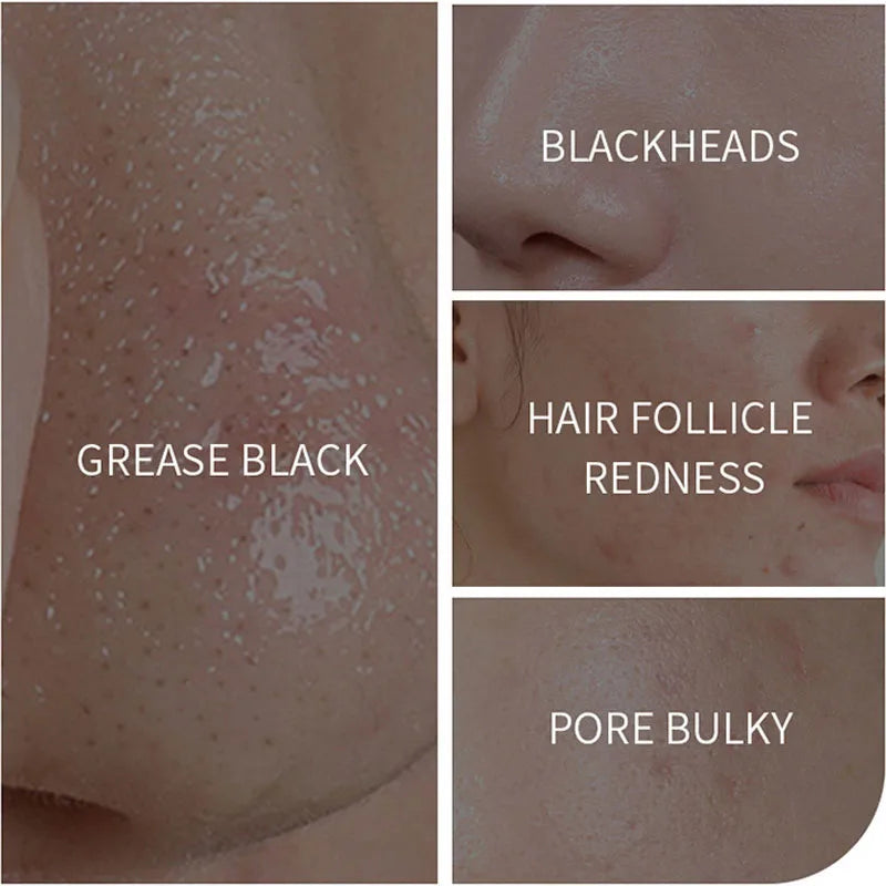 Face Clean Mask Green Tea Cleansing Stick Mask Men'S Blackheads Remove Pimples Shrink And Tear Nasal Strips facial Acne MasK